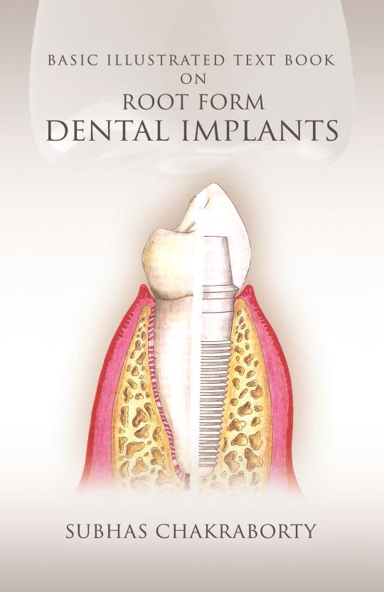 Basic Illustrated Text on Dental Implants